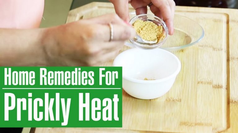 Prickly Heat: Ayurvedic Treatment, Medicines and Remedies